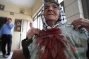 Settlers Stone Elderly Palestinian Lady